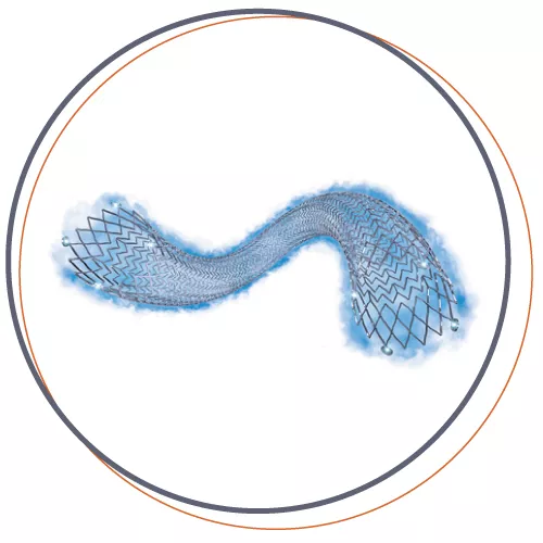 STENT FARMACOLÓGICO ELUVIA™