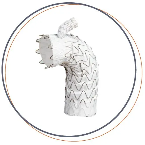 GORE® TAG® Thoracic Branch Endoprosthesis (TBE)