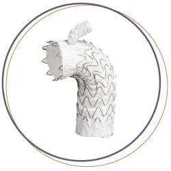 GORE® TAG® Thoracic Branch Endoprosthesis (TBE)