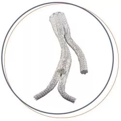 angiomedical gore EXCLUDER ILIAC BRANCH ENDOPROSTHESIS